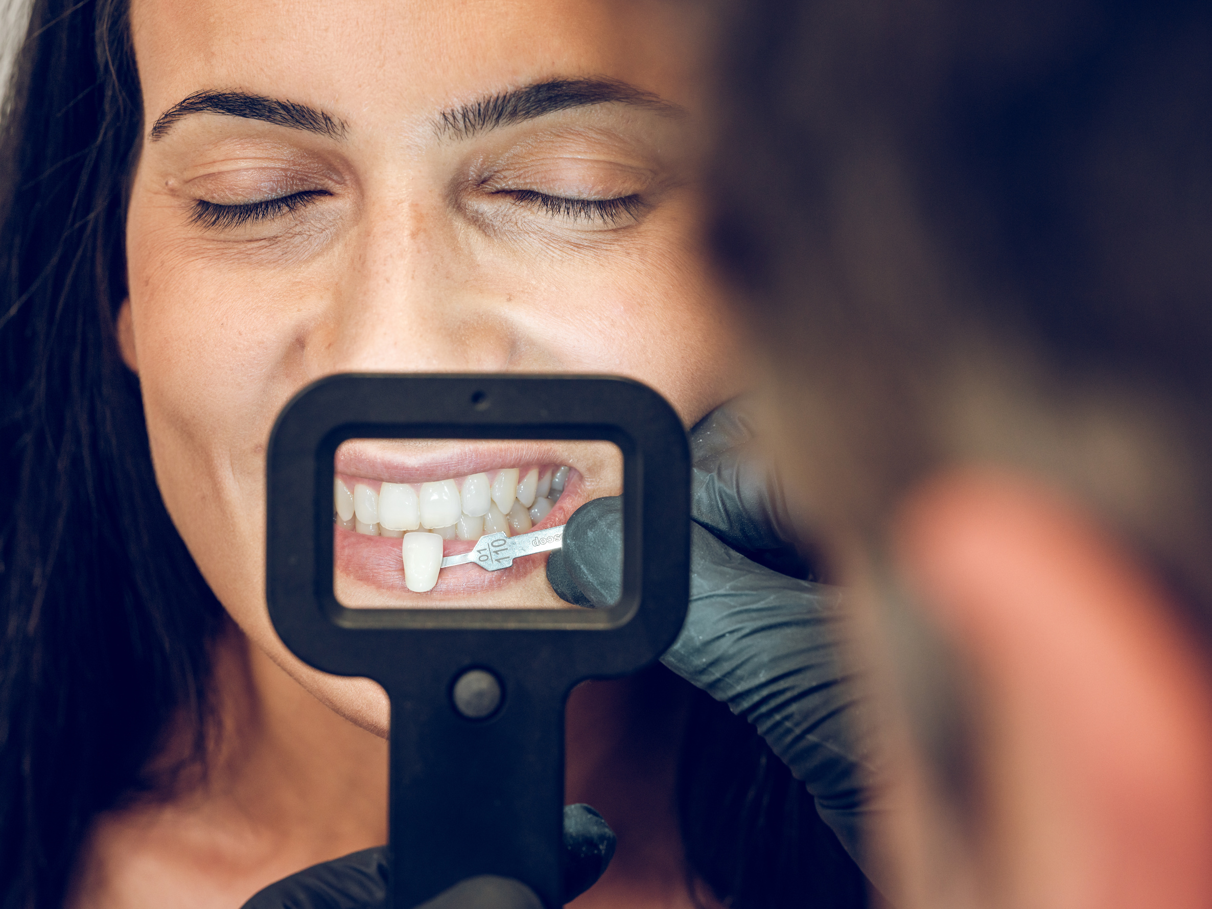 Dentist Picking Sample of Teeth Veneer for Woman